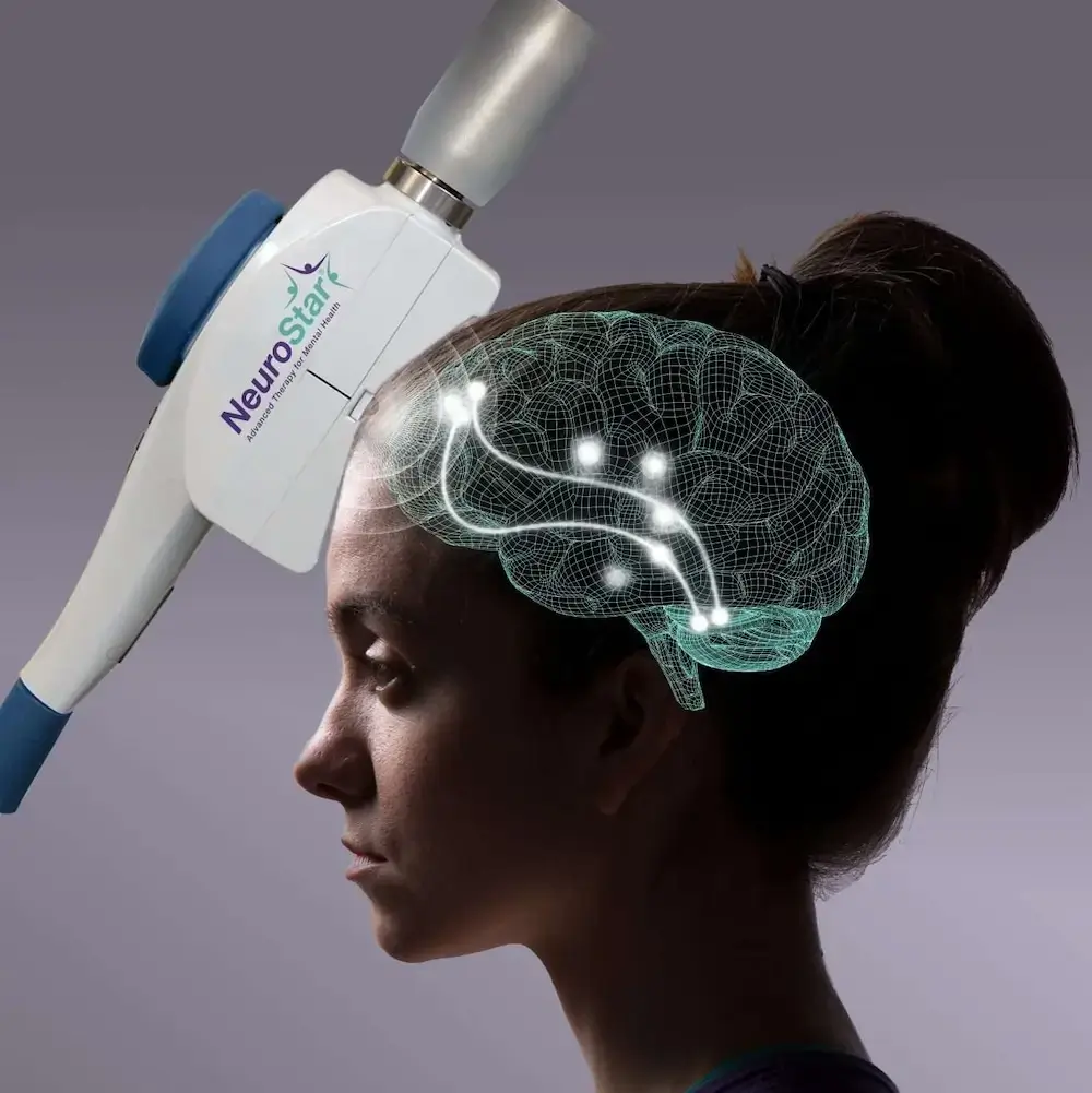 neurostar for tms therapy