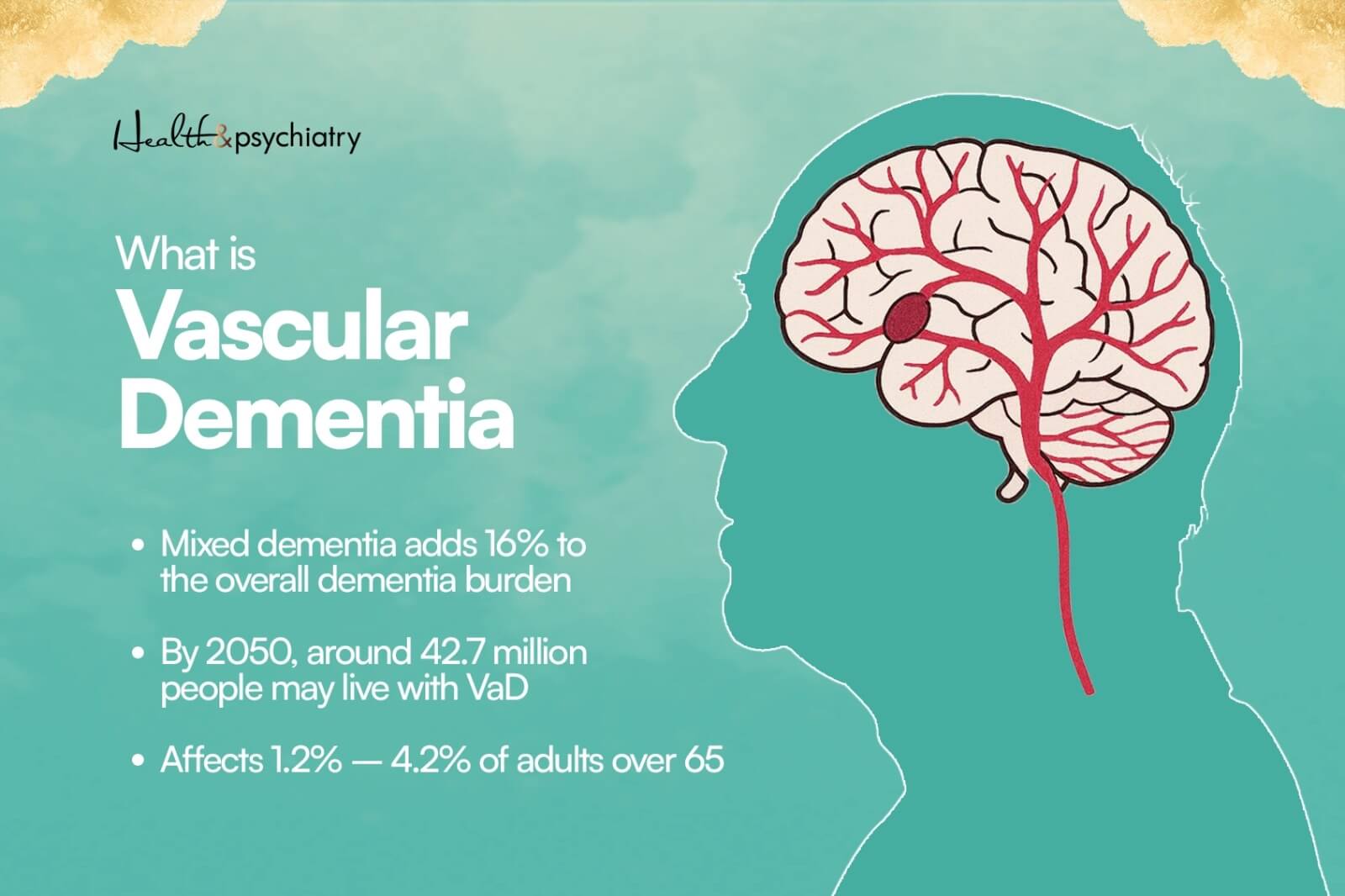 what is vascular dementia