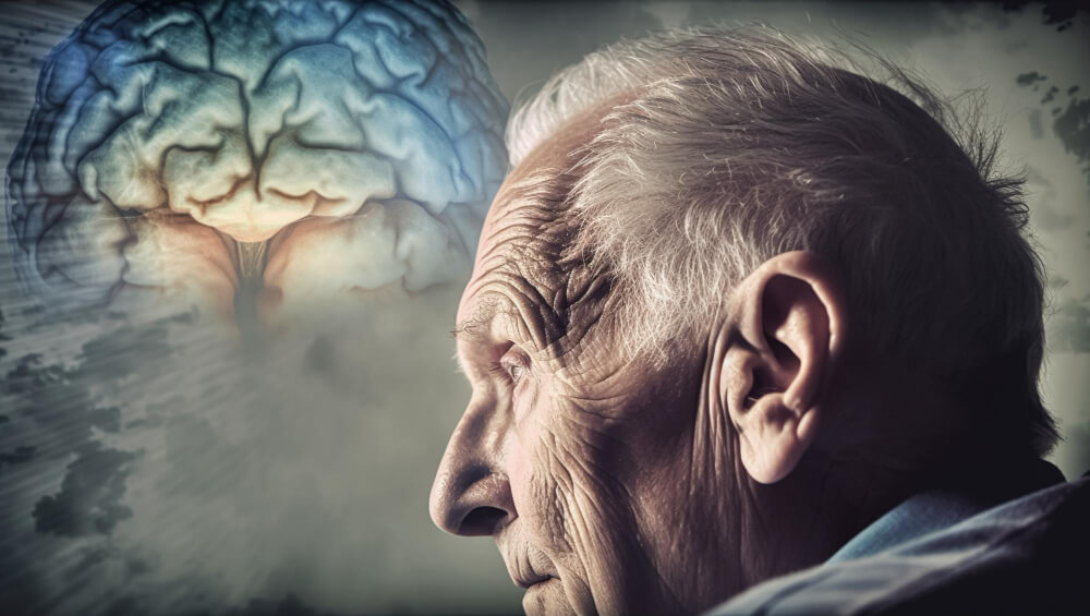 Vascular Dementia | Causes, Symptoms, Stages & Treatment